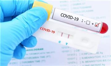 Các loại test nhanh Covid nào được Bộ Y tế cấp phép? Để test nhanh chính xác, cần lưu ý gì?