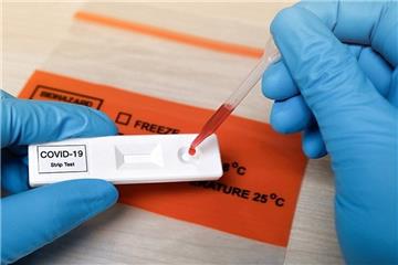Về quê có cần test PCR không? Dùng kết quả test nhanh có được chấp nhận?