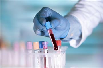 Xét nghiệm máu có được hưởng bảo hiểm y tế không?