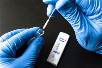 Nghi nhiễm Covid-19, có cần thiết phải test PCR không?