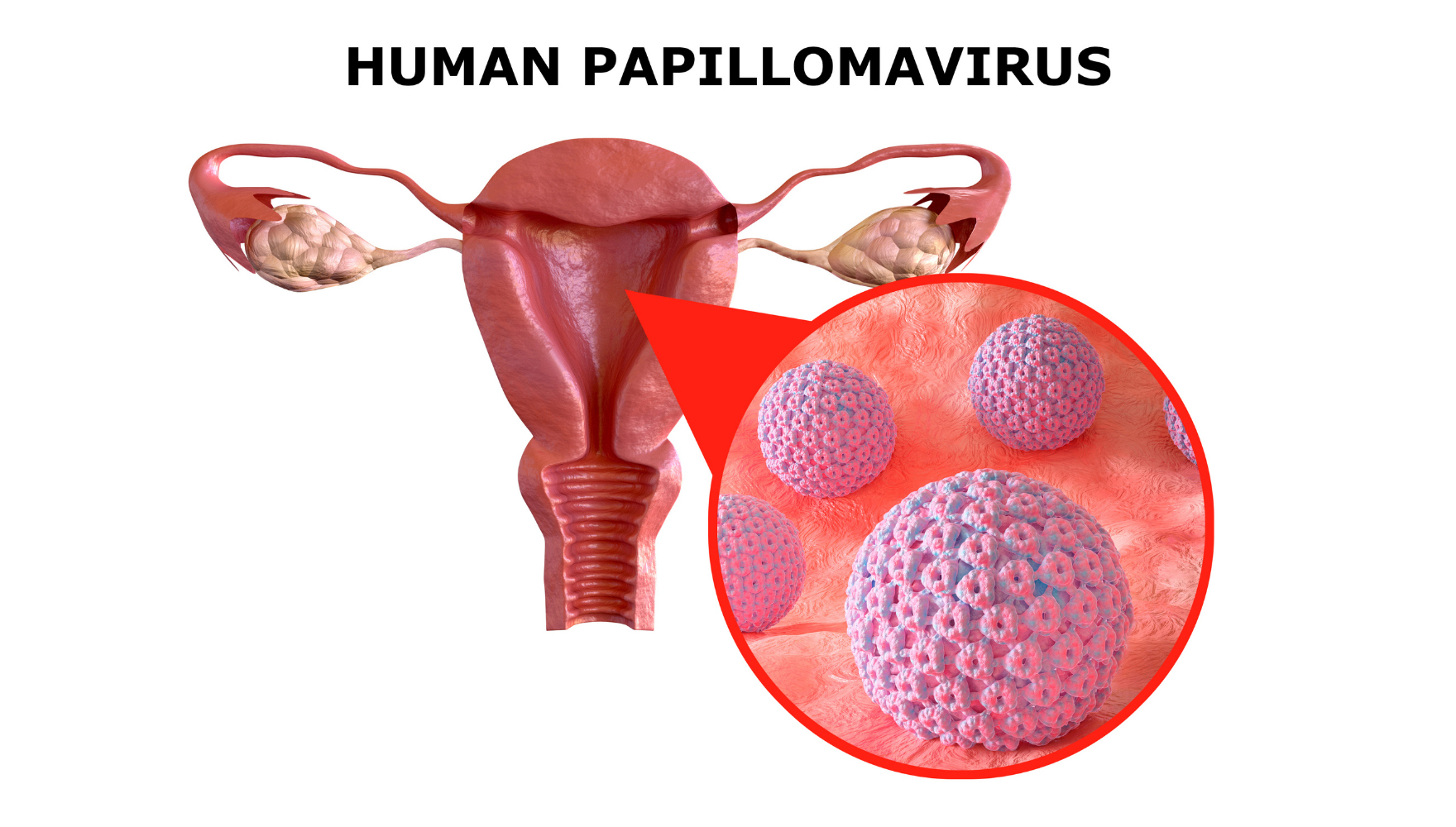 HPV là gì HPV la gi