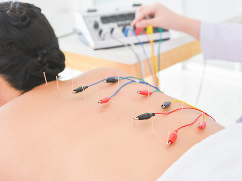 Điều kiện mở phòng khám châm cứu