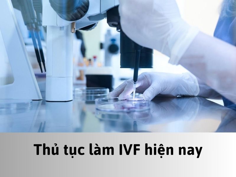 Thủ tục làm IVF
